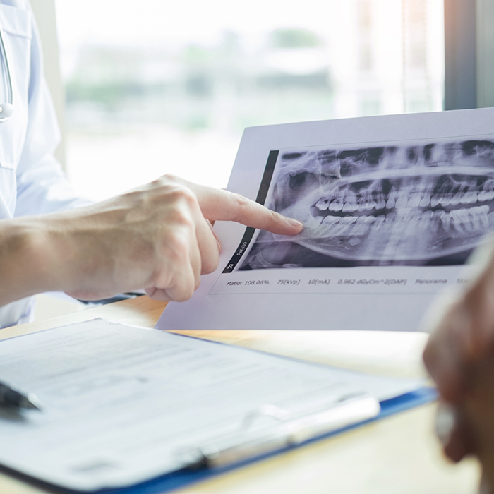 Dentist showing a patient an x ray of their teeth