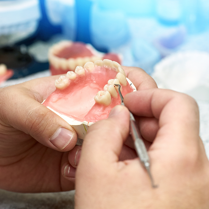 Ceramist adjusting a denture