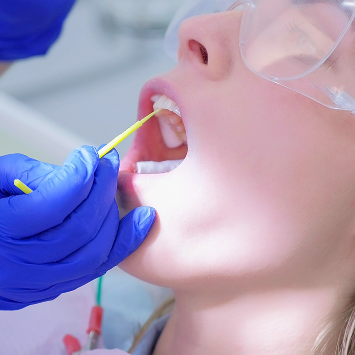 Dental patient having fluoride applied to their teeth