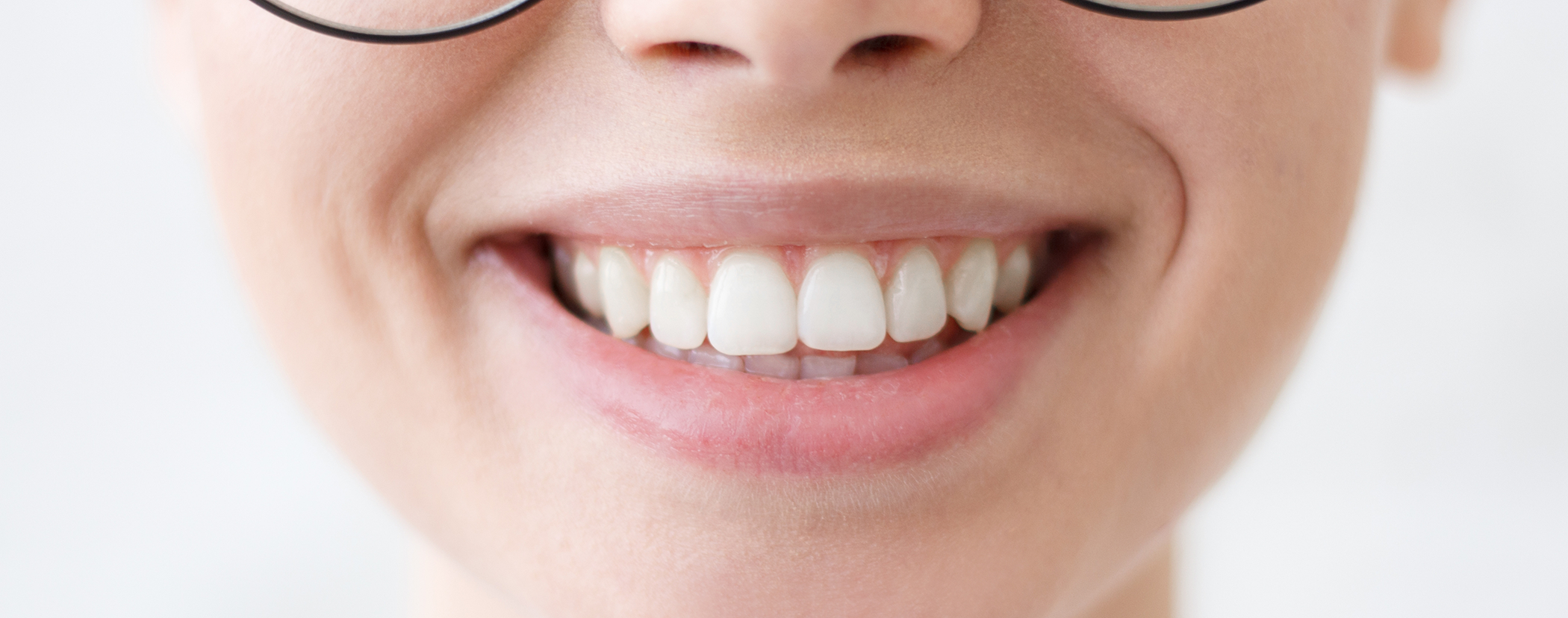 Close up of a smile with flawless teeth