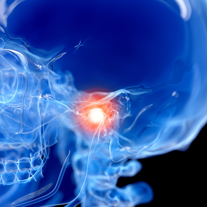 Illustrated x ray of a skull with the jaw joint highlighted