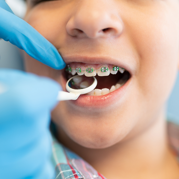 Child with traditional braces getting a dental exam